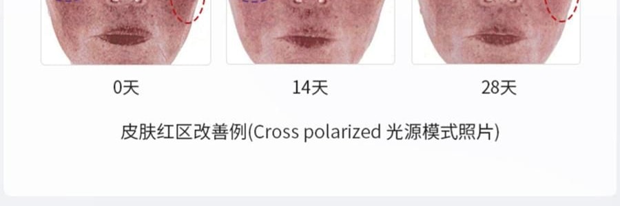 VOOLGA敷尔佳 多元益生修护贴面膜 益生膜 26g*5片入 补水保湿 修泛红 稳屏障 缓解干·痒·红 换季妆前熬夜修复