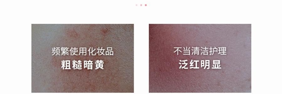 VOOLGA敷尔佳 多元益生修护贴面膜 益生膜 26g*5片入 补水保湿 修泛红 稳屏障 缓解干·痒·红 换季妆前熬夜修复