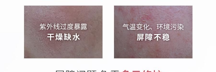 VOOLGA敷尔佳 多元益生修护贴面膜 益生膜 26g*5片入 补水保湿 修泛红 稳屏障 缓解干·痒·红 换季妆前熬夜修复