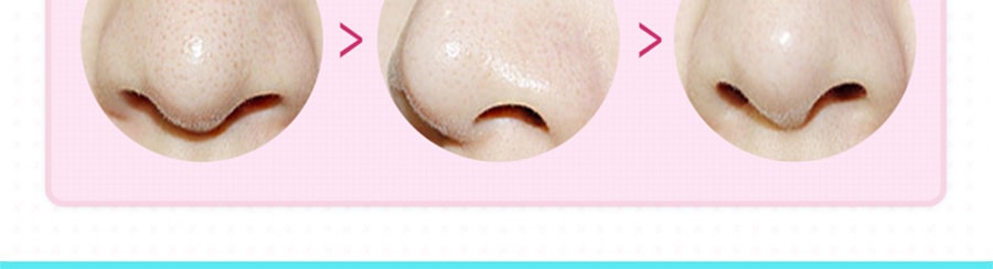 韓國HOLIKA HOLIKA 豬鼻貼三部曲 1件入 去黑頭粉刺清潔套裝 收縮毛孔