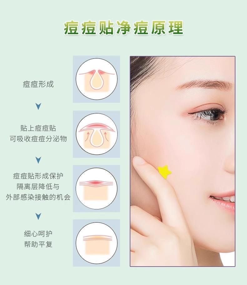 FOXTAIL 日本こうしつ 星星痘痘贴 遮盖 可上妆 可爱 痘痘遮瑕 祛痘贴 - 200粒 1包