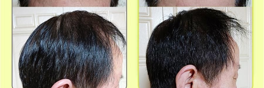 韩国GRABITY 防脱固发洗发水 加强型 475ml​​ 缓解脱发 极细发质/短发专研