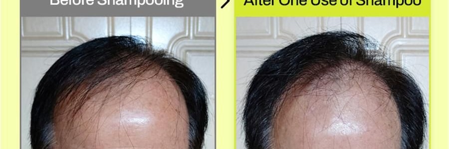 韩国GRABITY 防脱固发洗发水 加强型 475ml​​ 缓解脱发 极细发质/短发专研