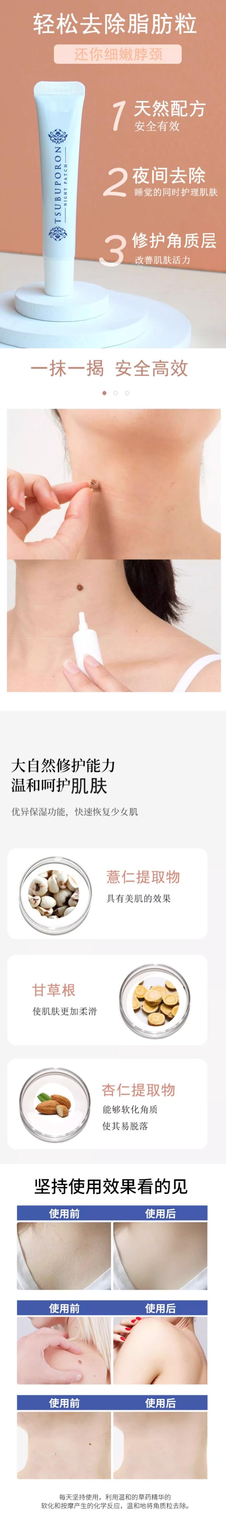 【日本直邮】 日本 TSUBUPORON 胸部颈部去脂肪粒 去疣膏 20g