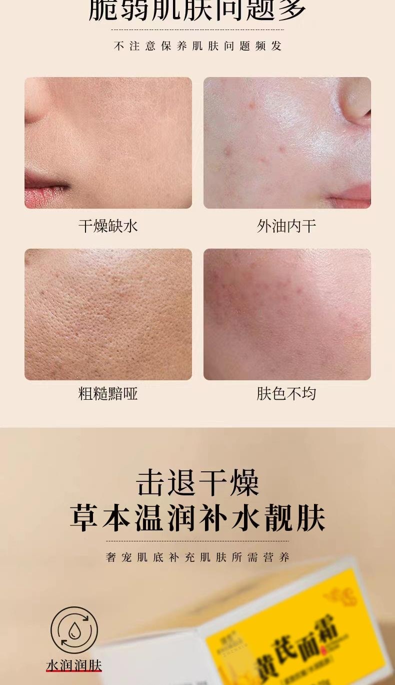 Astragalus Cream Moisturizing And BrighTening Astragalus Essence Cream 70g/ box (Selected)