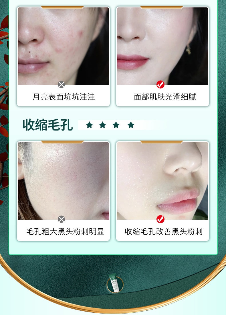 【中國直郵】水楊酸 清爽淨膚潔面乳 120g