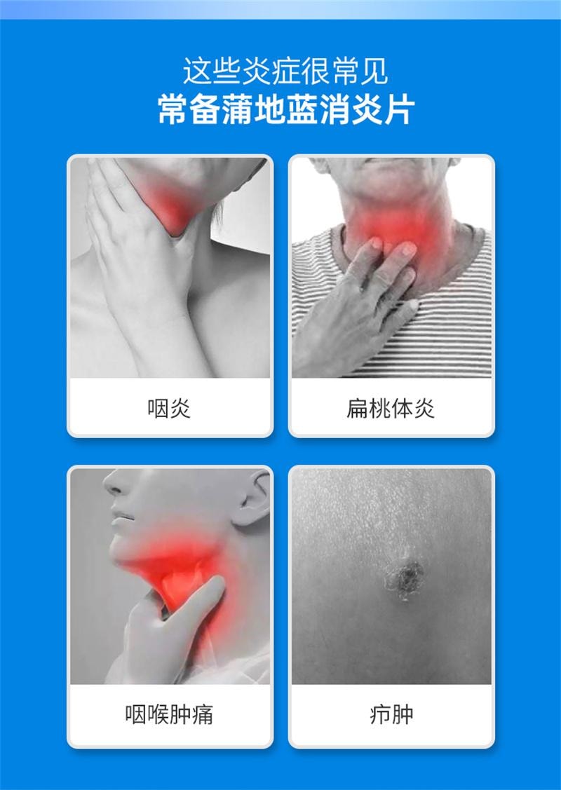 【中国直邮】 云南白药 蒲地蓝消炎片 清热解毒 消炎消肿 咽炎 扁桃体炎 0.3g*48片/盒