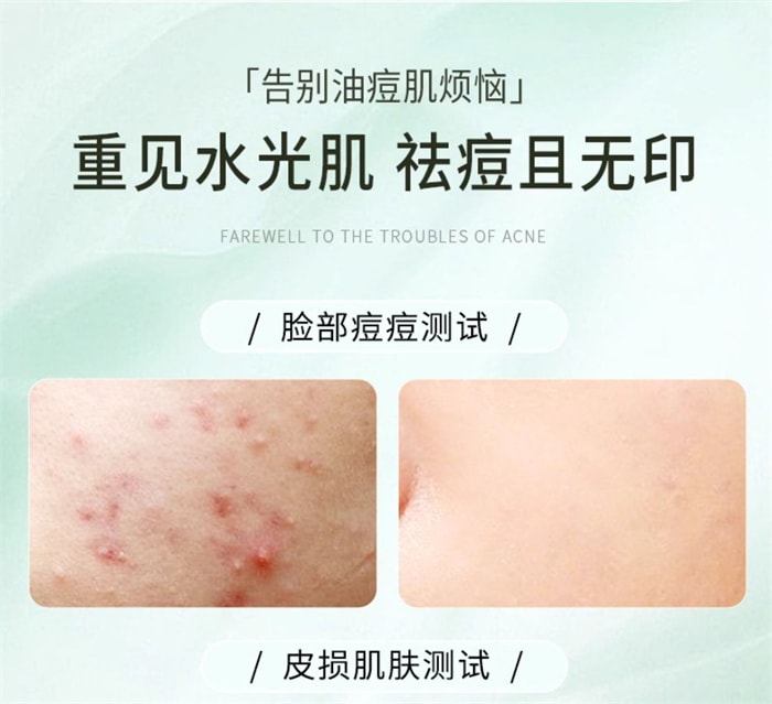【中国直邮】CJ 水杨酸祛痘膏 青春期学生植粹祛痘 调养痘肌告别反复 30g/支(告别痘肌烦恼)