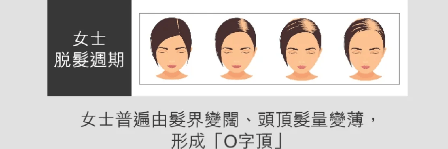 VITA GREEN维特健灵 维新乌丝素 野生制首乌灵芝生发养发 滋补食疗胶囊 90粒入 减少脱发 强韧发丝