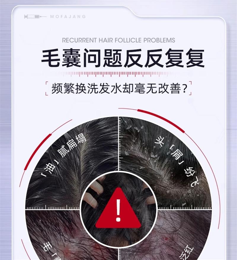【中国直邮】 三个魔发匠 二硫化硒去屑洗发水毛囊清洁控油蓬松止痒洗头膏 400ml