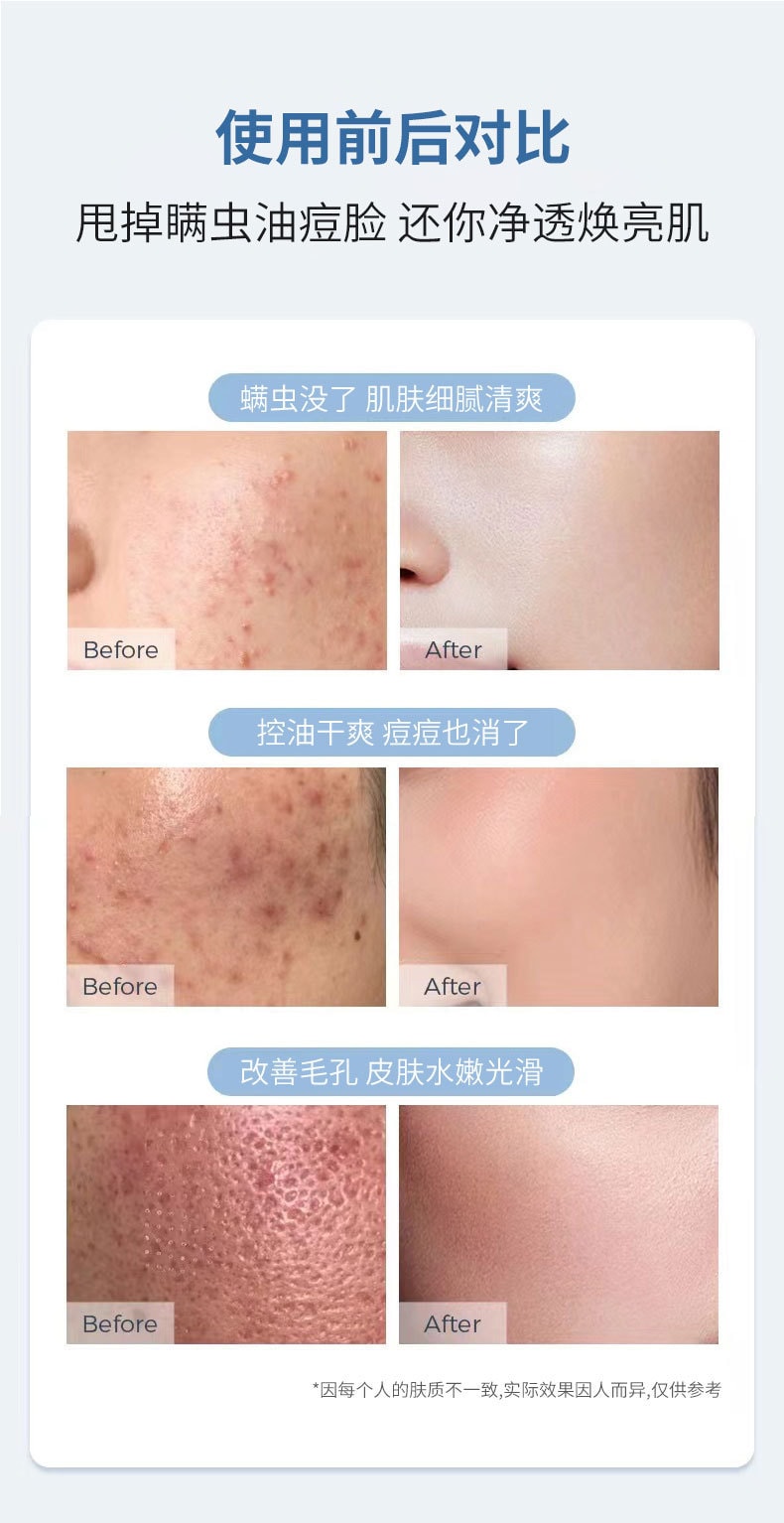 【中國直郵】 仁和 氨基酸控油淨顏潔面乳 180g