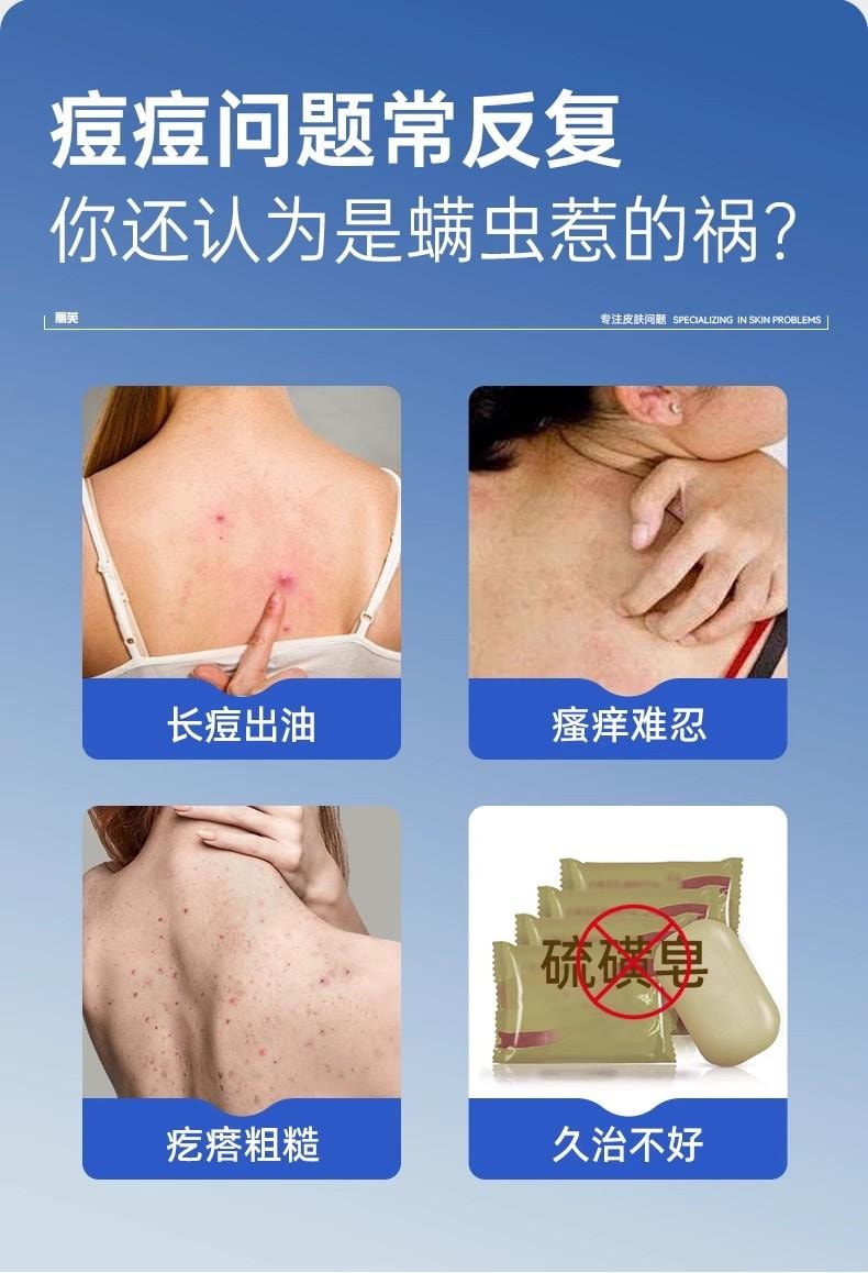 【中国直邮】 丽芙 外用溶液 毛囊炎前胸后背祛痘喷雾背部祛痘除螨 30ml/瓶