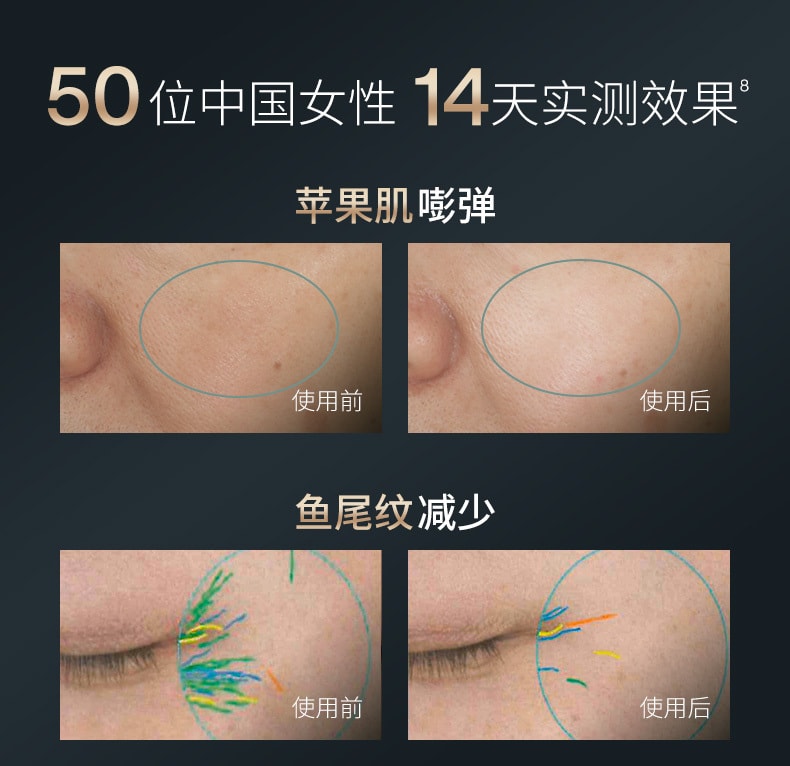 【年中特惠】中國直郵AMIRO覓食S1膠原炮美容儀器家​​用熱瑪吉臉部提拉緊緻嫩膚射頻儀送美眼儀*1面膜*2