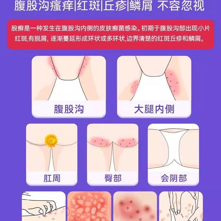 Bifonazole cream 15g per vial