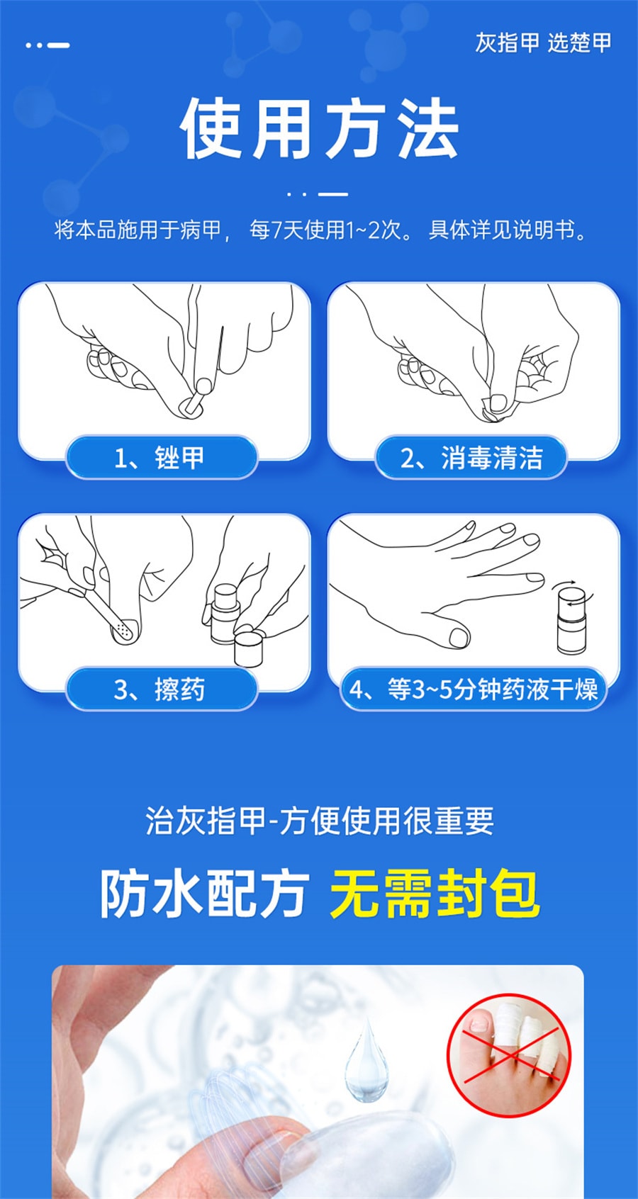 【中国直邮】楚甲 盐酸阿莫罗芬搽剂 灰指甲正品治疗脚气甲癣  1.5ml/盒