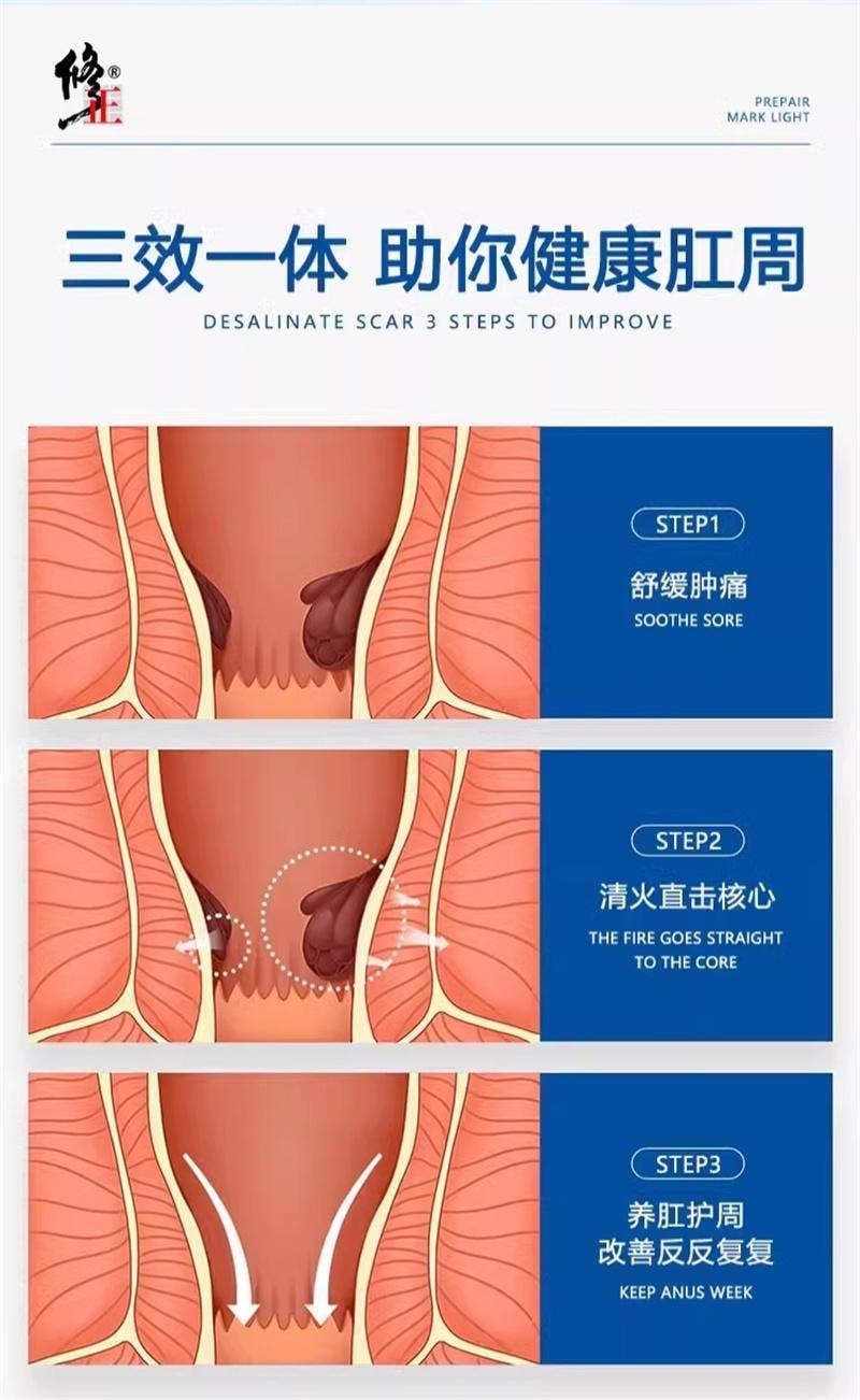 【中國直郵】 修正 卡波姆痔瘡膏醫用凝膠肛門軟膏內痔混合痔瘡專用 15g/支