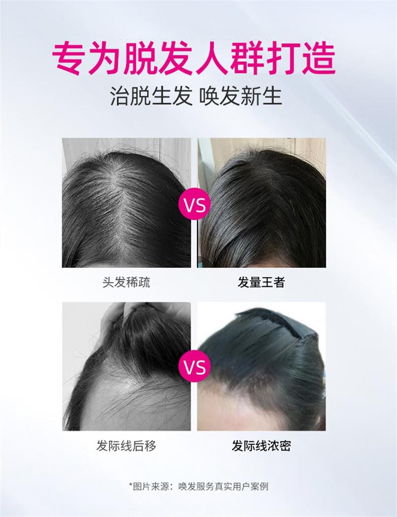 【中國直郵】 仁和 米諾地爾搽劑生髮液女性專用非酊脫髮增發 120ml