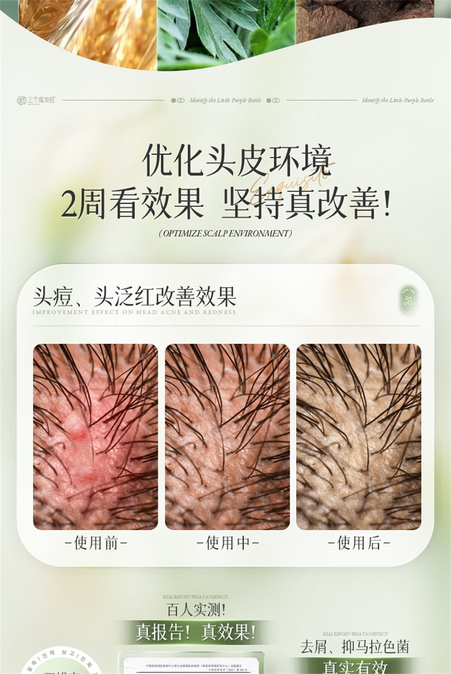 【中国直邮】三个魔发匠 二硫化硒毛囊洗发水控油蓬松去屑止洗头膏露炎男女专用痒 400ml