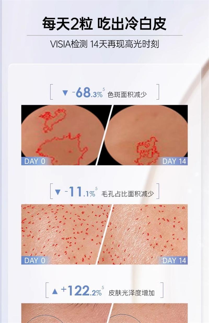 【中国直邮】 碧维斯 打斑美白丸 全身美白淡纹祛斑谷胱甘肽葡萄籽褪黑丸 40粒/盒