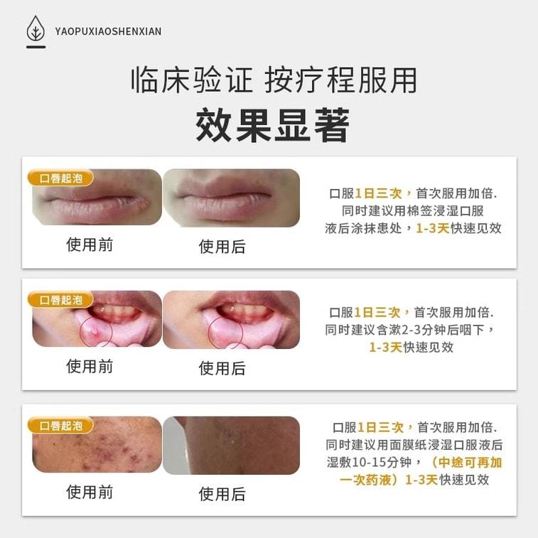 【中国直邮】 真奥金银花药业 金银花口服液 口腔溃疡药 咽炎上火清热解毒 祛火抗炎 祛痘 20ml*10支/盒