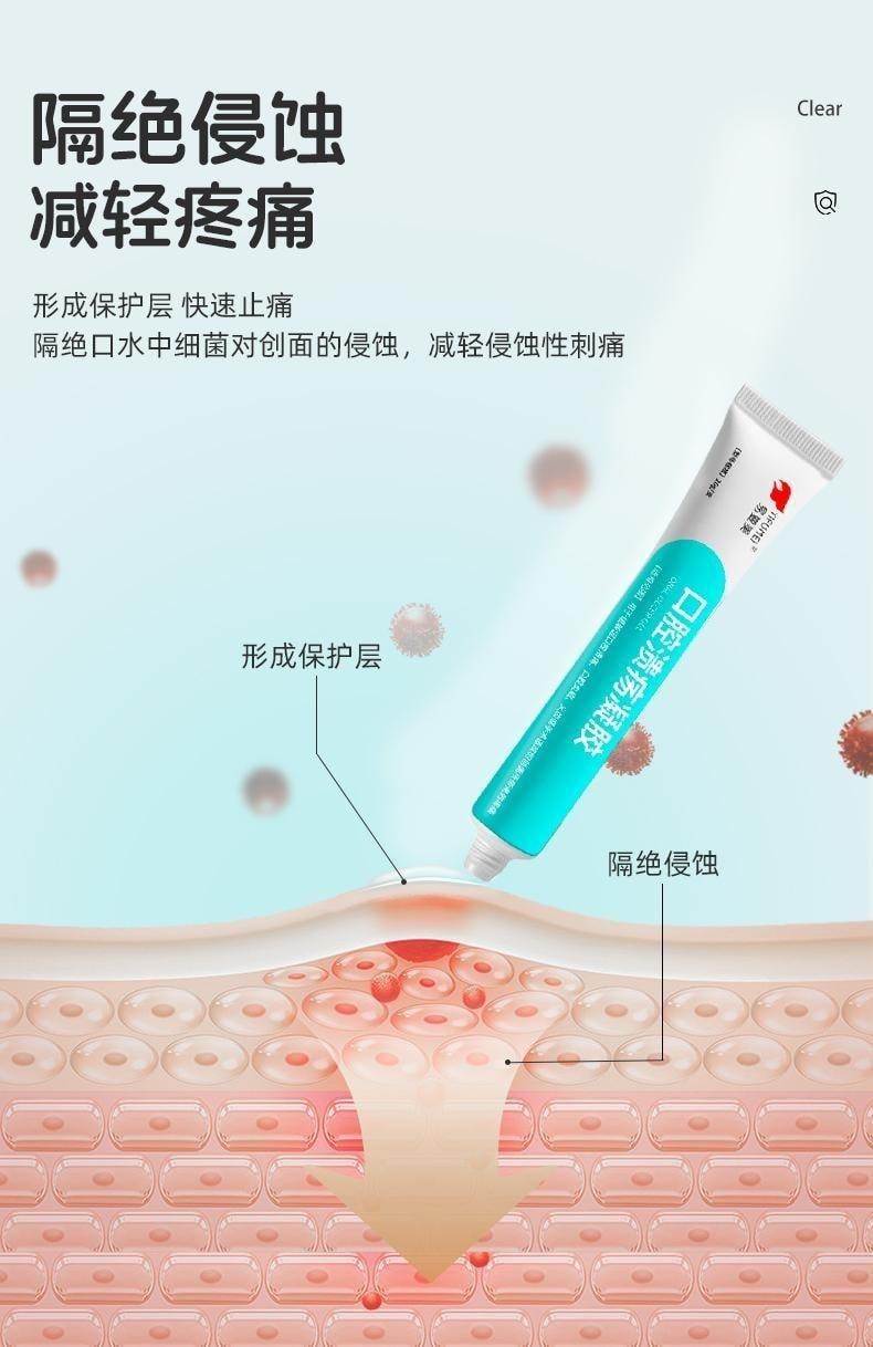【中国直邮】 易复美 口腔溃疡凝胶 隔绝侵蚀 减轻疼痛 缓解疼痛保护创面 20g/支