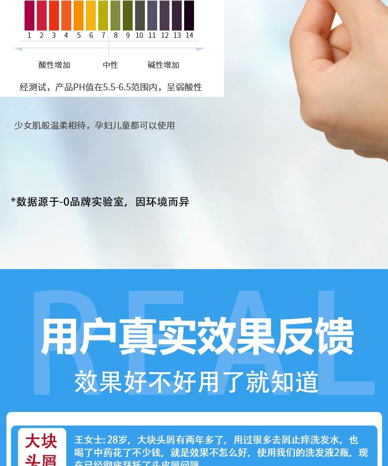  祥医堂 煤焦油抑菌洗液 抗皮脂溢出 改善止痒头皮控油去屑神器洗发水 60ml/盒