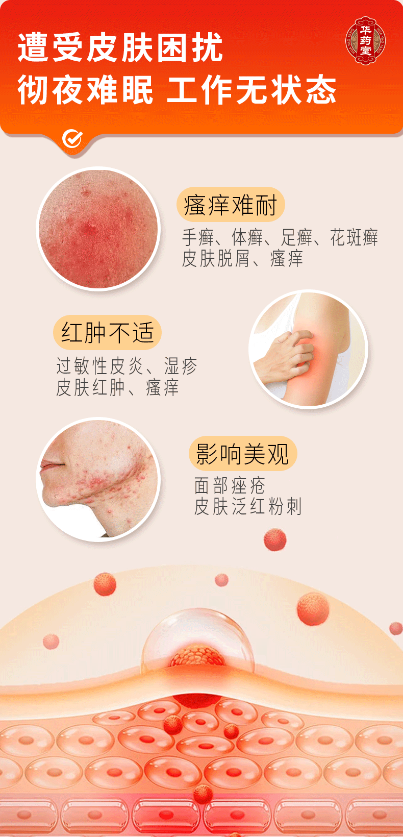 華藥堂 百癬濕毒清錠 0.31g*72片 手癬 腳癬 體癬 花斑癬 過敏性皮膚炎 痤瘡 消腫止痛止癢