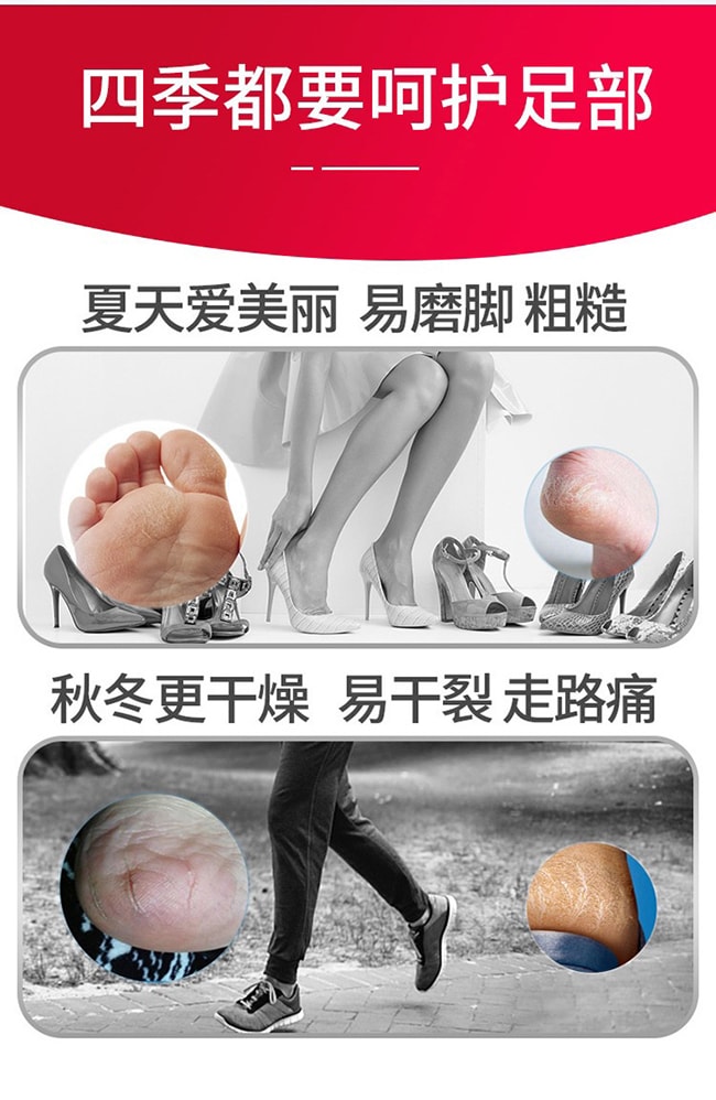 【日本直郵】KOBAYASHI小林製藥 腳跟特效保濕修護防裂膏 足部保濕膏腳跟潤足棒膏30g