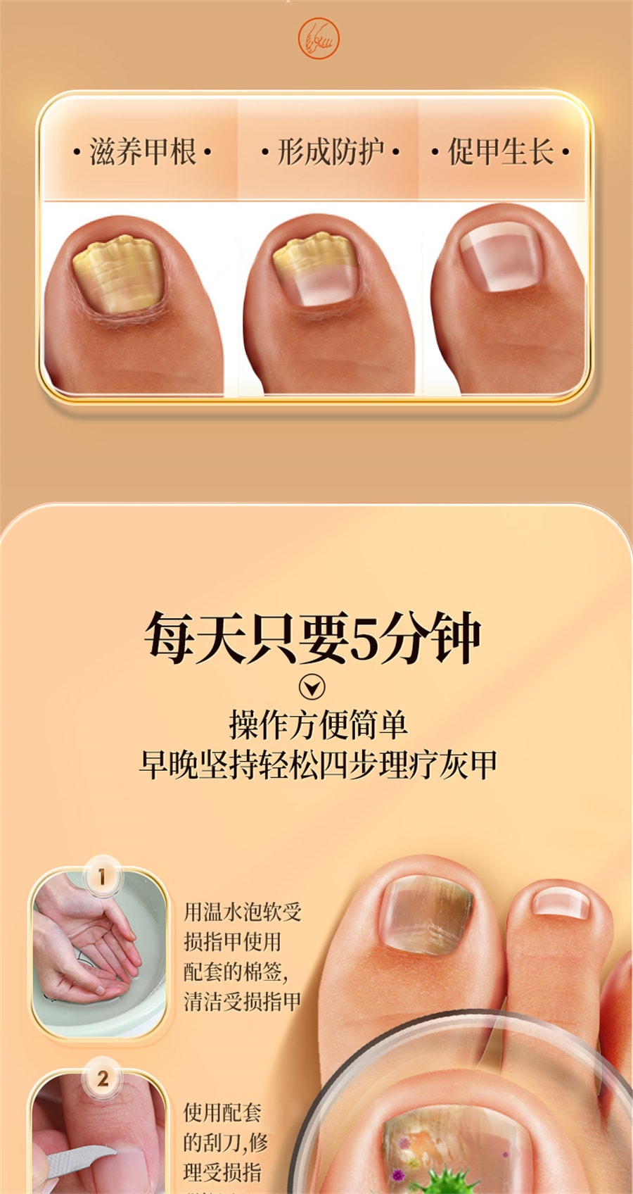 美國 北京同仁堂 灰指甲專用液體 甲溝炎藥水修腳剪刀冰醋酸抑菌液 30g