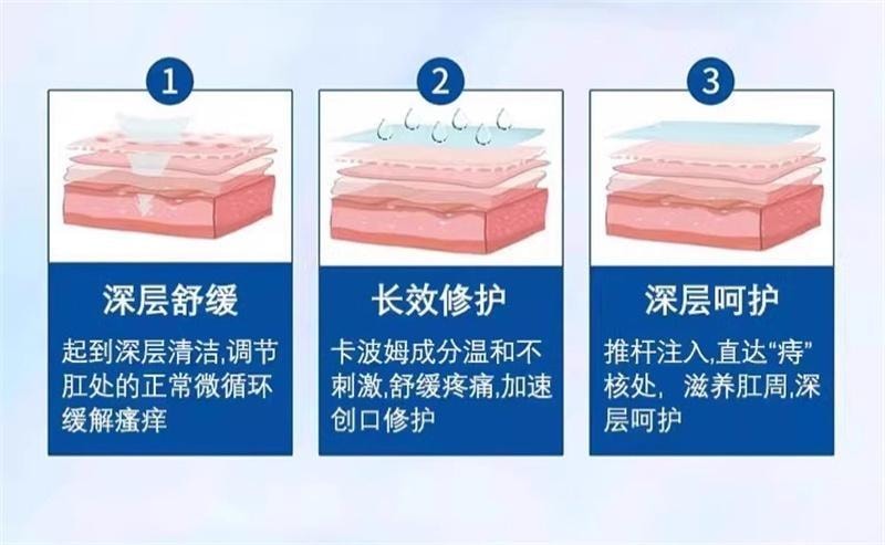 【中國直郵】 修正 卡波姆痔瘡膏醫用凝膠肛門軟膏內痔混合痔瘡專用 15g/支