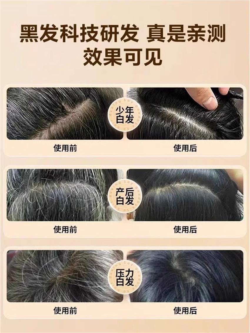 【中国直邮】 北京同仁堂 黑灵芝何首乌洗发水白发治根转黑侧柏叶防脱露 550ml