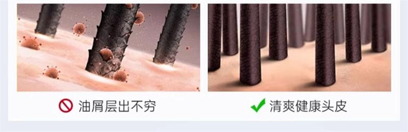 【中國直郵】 康王 去屑洗髮精二硫化硒洗髮液止癢控油蓬鬆頭皮清潔洗髮露洗頭膏 清爽淨澈 460ml