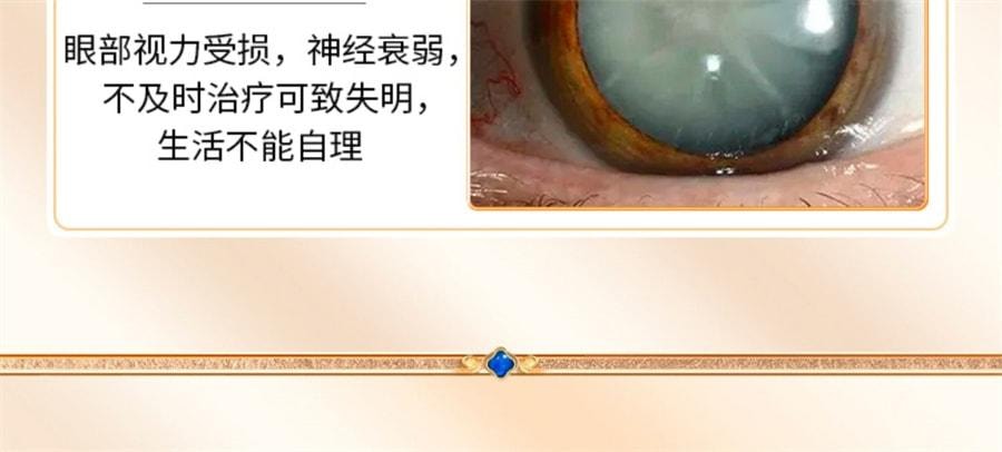 【中国直邮】 太极 拨云退翳丸 散风明目 消障退翳 用于目翳外障视物不清隐痛流泪 10袋/盒