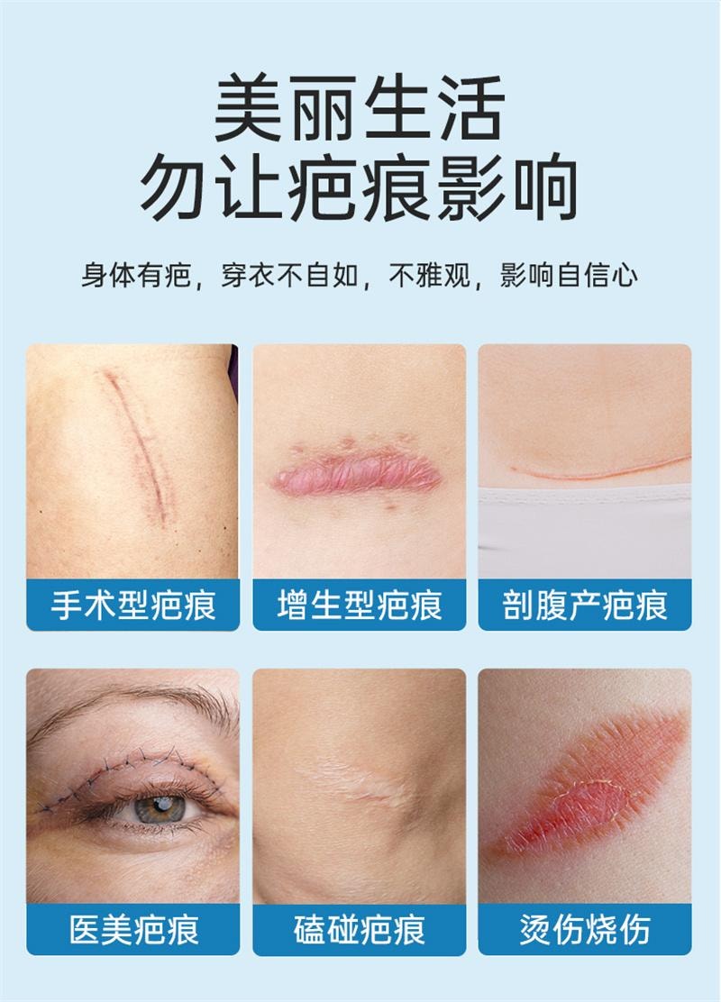 【中国直邮】 亿普 疤痕贴 医用祛疤贴 硅凝胶剖腹产去疤修复儿童手术增生除疤隐形贴 3贴/盒