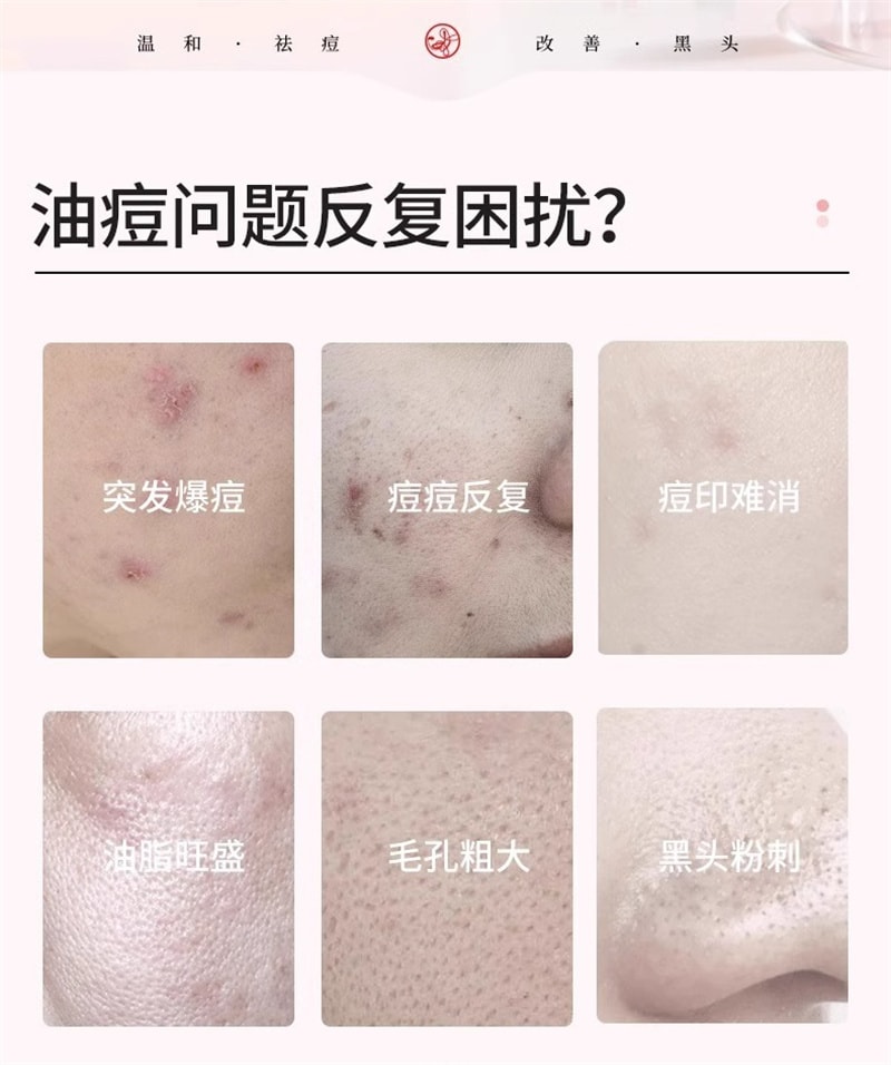 【中国直邮】歌宝莲 15%壬二酸凝胶祛痘印修复淡化坑任水杨酸去黑头收缩毛孔 30g