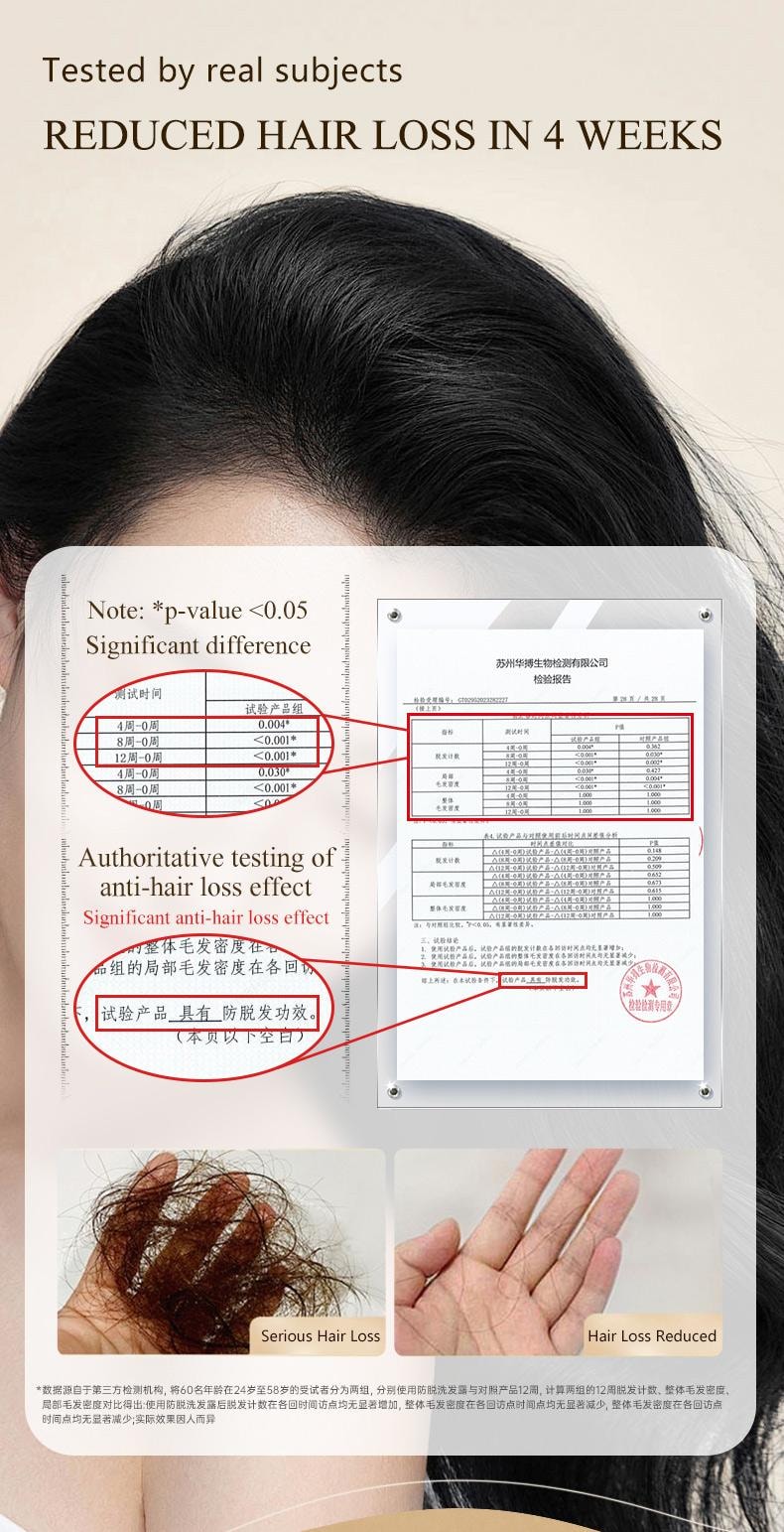 Sipimo詩碧曼 人參何首烏防脫洗髮精 產後熬夜脫髮固髮洗頭膏 蓬鬆增髮洗髮露 產後壓力性脫髮熬夜固發密發 瑞士毛囊靶向強韌毛囊激活 90天增厚發量 臨床數據驗證 420ml