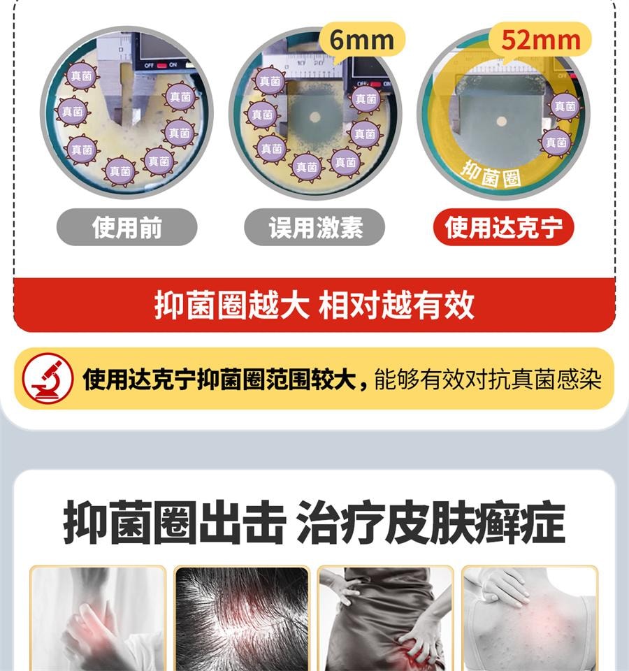  达克宁 酮康唑乳膏股癣专用药汗斑花斑癣药膏体癣手足癣花斑止痒 15g /支