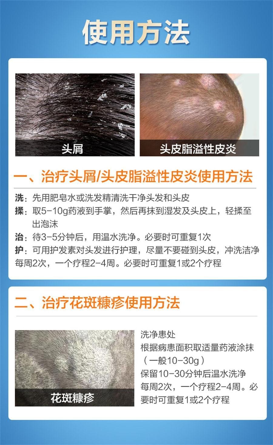 希尔生 二硫化硒洗剂 脂溢性皮炎去头皮屑毛囊炎洗发水止痒花斑汗癣 100g*1瓶/盒(小红书种草推荐)