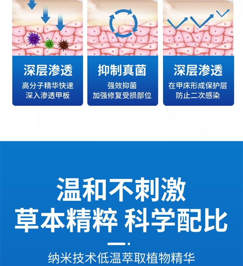 【中国直邮】 祥医堂 阿莫灰甲抑菌擦剂 修复灰指甲脱甲液 阿莫罗芬搽剂灰指甲正品 5ml/盒