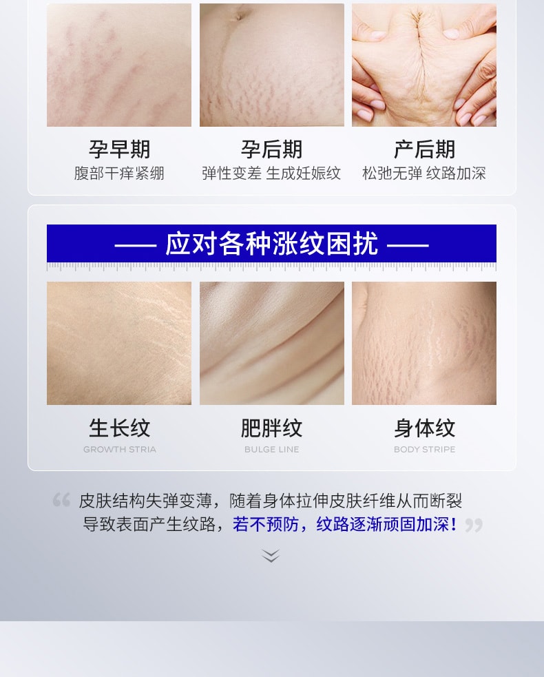 【中國直郵】 華美科 妊娠紋孕婦修補霜 祛肥胖紋淡化藥膏 產後專用消除浬花緊緻肚皮 50g/瓶