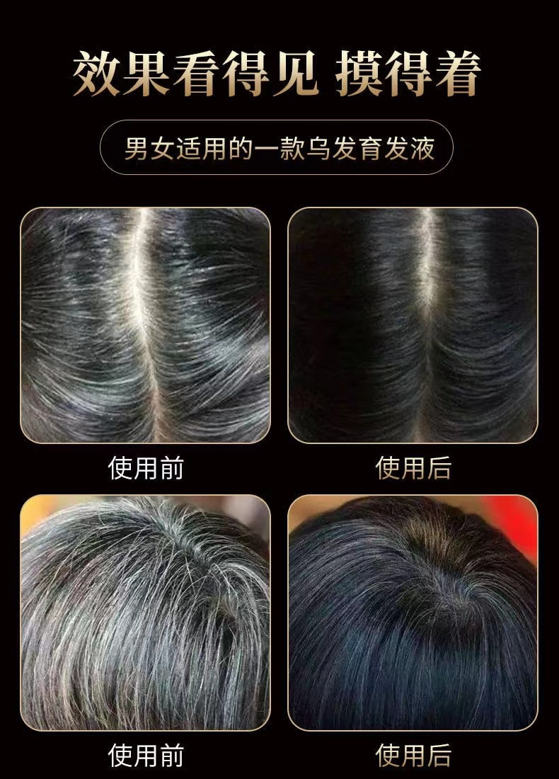 【中國直郵】 南京同仁堂 修護髮質烏黑烏髮液 補充毛髮營養 重現烏黑秀發100ml(護髮神器)