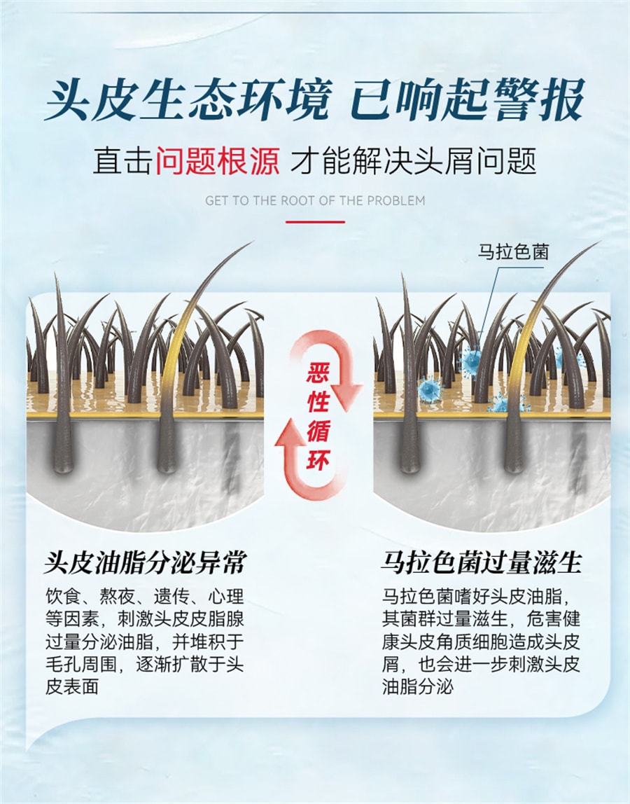 【中国直邮】999  二硫化硒洗发水去屑控油蓬松脂溢性皮炎毛囊清洁洗发乳止痒  200ml/瓶