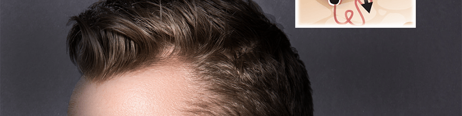 韓國MBA 頭皮集中護理生髮精華液 20ml 脫髮救星 改善頭皮環境