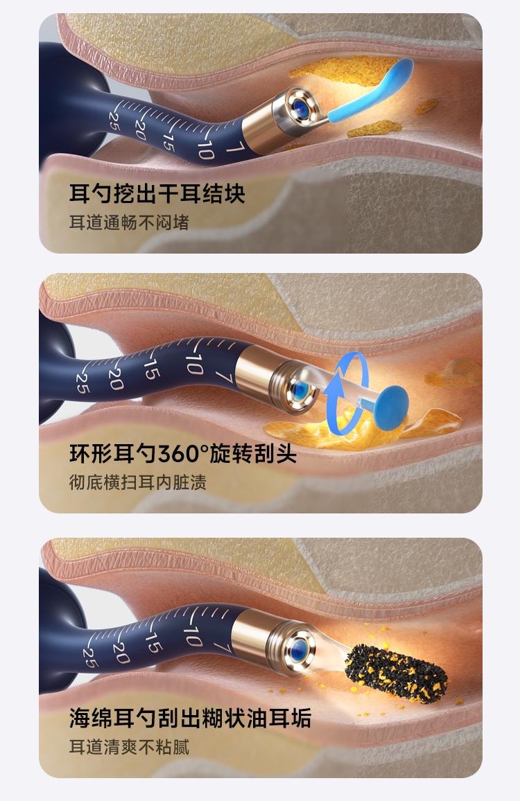 【满足全家采耳需求】新年好礼 Bebird黑蜂蜂鸟可视掏耳勺高清挖耳勺镊子儿童掏耳朵神器采耳工具套装 深蓝1套