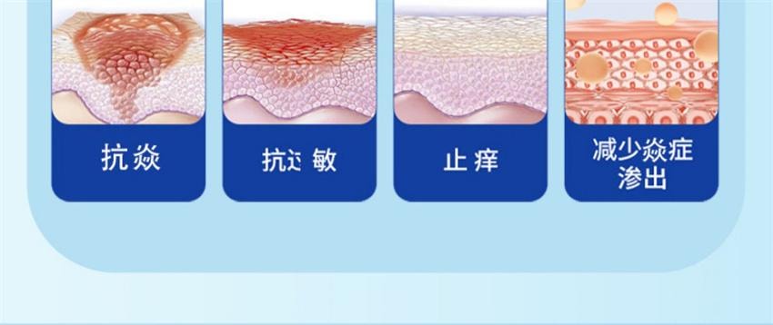 【中国直邮】 祥医堂 地奈德乳膏 适用于神经性皮炎 湿疹 皮肤瘙痒药膏 15g/盒(医师推荐拍3盒)