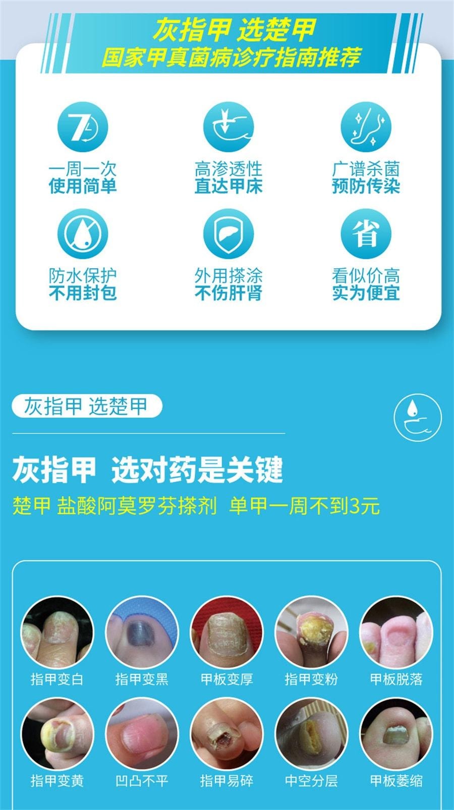 【中國直郵】 楚甲 鹽酸阿莫羅芬搽劑1ml治療灰指甲專用藥增厚甲癬 1mL x 1盒