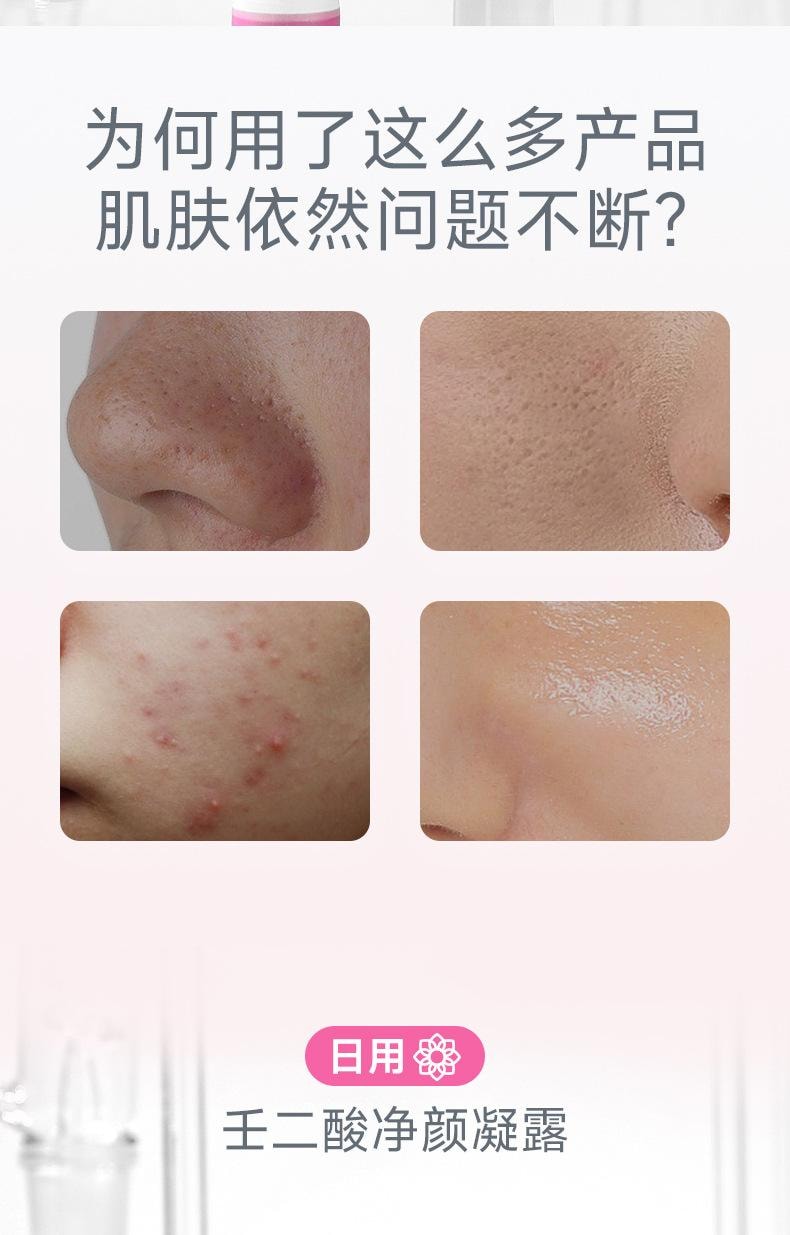 【中国直邮】 诺维娅 水杨酸细致毛孔霜 适用于收缩毛孔 黑头 痘印 粉刺凝胶 20g/支(夜用)