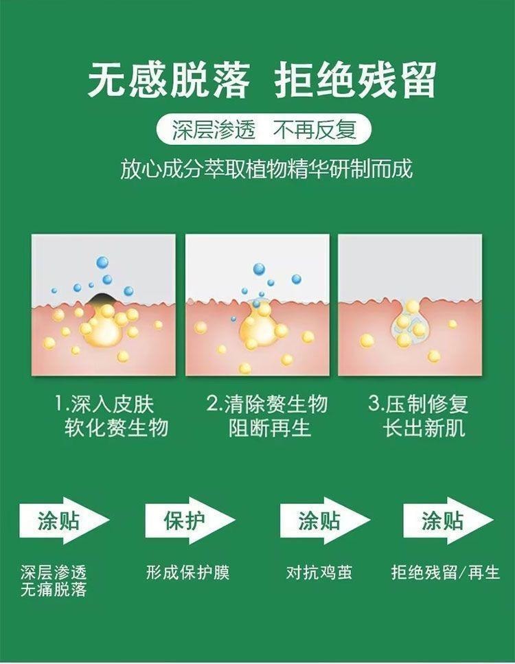 云南本草 鸡眼膏抑菌膏去鸡眼膏跖疣瘊子肉刺老茧除鸡眼贴 20g/盒(建议拍6支)
