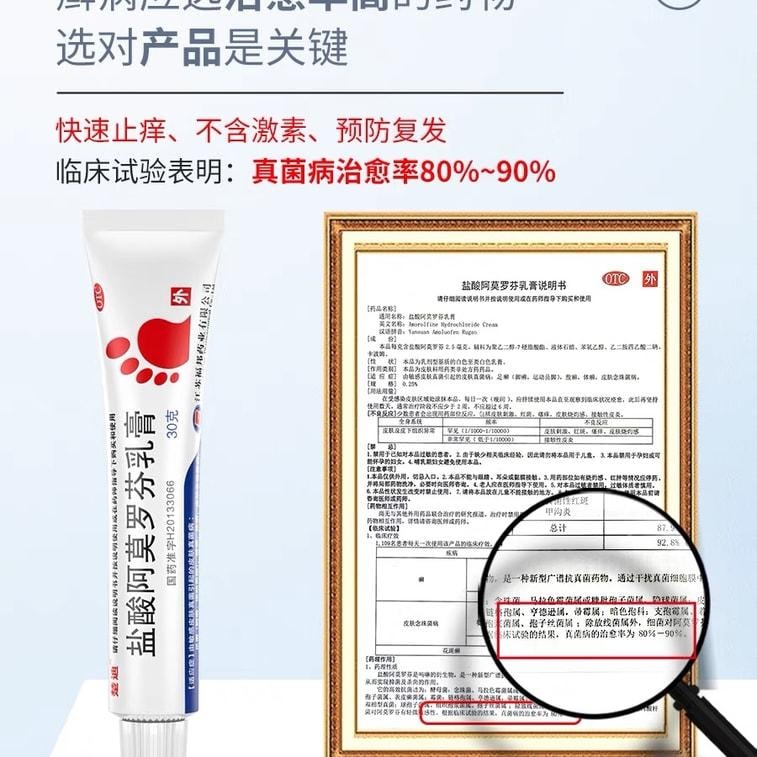 【中国直邮】 楚甲 盐酸阿莫罗芬乳膏去脚气治脚气脱皮止痒杀菌 30g/支