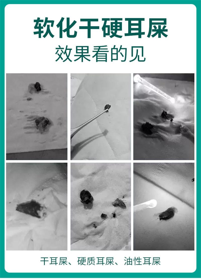【中国直邮】 仁和 碳酸氢钠滴耳液儿童宝宝耳屎软化液耳道清洗耳结石耵聍成人洗耳液  10ml